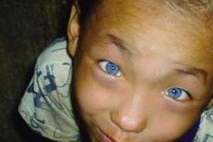 广西9岁猫眼男孩之谜，天生蓝瞳孔具有夜视眼(视频/真相)
